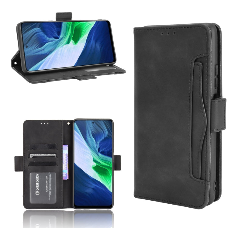 Skin Feel Calf Pattern Horizontal Flip Leather Case with Holder & Card Slots & Photo Frame, For Infinix Hot 10s/10s NFC/10T, For Infinix Note 10 Pro/Note 10 Pro NFC, For Infinix Note 10, For Xiaomi Redmi Note 10 5G, For Xiaomi Redmi Note 10 JP Version