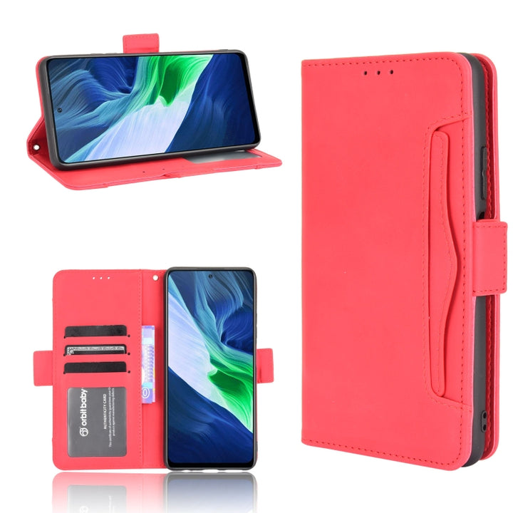 Skin Feel Calf Pattern Horizontal Flip Leather Case with Holder & Card Slots & Photo Frame, For Infinix Hot 10s/10s NFC/10T, For Infinix Note 10 Pro/Note 10 Pro NFC, For Infinix Note 10, For Xiaomi Redmi Note 10 5G, For Xiaomi Redmi Note 10 JP Version