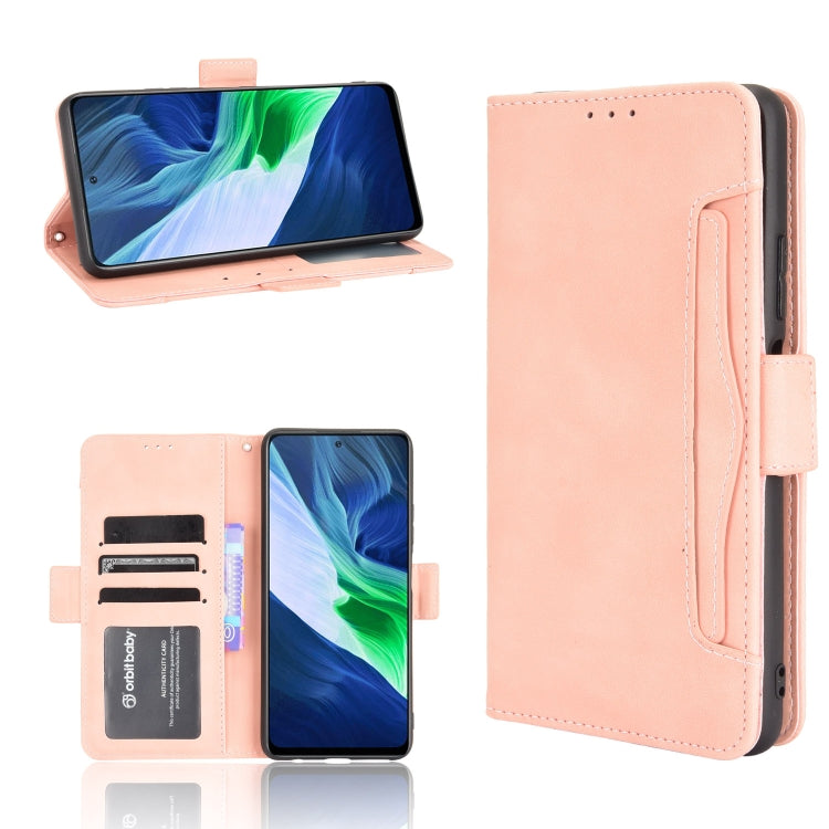 Skin Feel Calf Pattern Horizontal Flip Leather Case with Holder & Card Slots & Photo Frame, For Infinix Hot 10s/10s NFC/10T, For Infinix Note 10 Pro/Note 10 Pro NFC, For Infinix Note 10, For Xiaomi Redmi Note 10 5G, For Xiaomi Redmi Note 10 JP Version