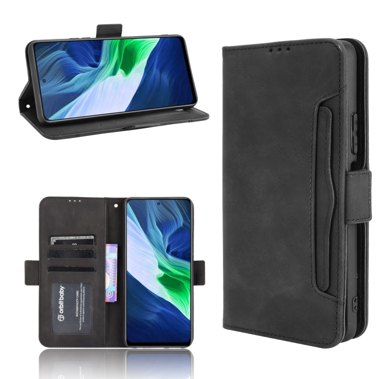 Skin Feel Calf Pattern Horizontal Flip Leather Case with Holder & Card Slots & Photo Frame, For Infinix Hot 10s/10s NFC/10T, For Infinix Note 10 Pro/Note 10 Pro NFC, For Infinix Note 10, For Xiaomi Redmi Note 10 5G, For Xiaomi Redmi Note 10 JP Version