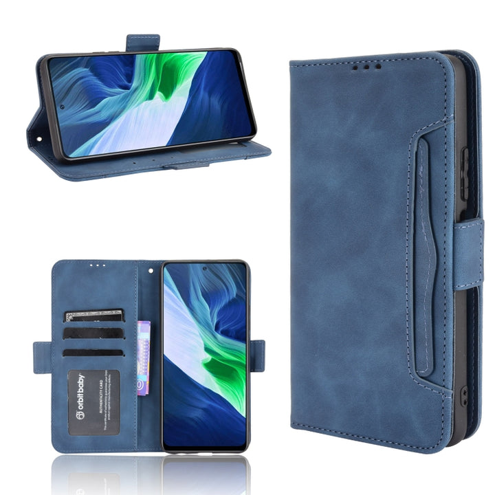 Skin Feel Calf Pattern Horizontal Flip Leather Case with Holder & Card Slots & Photo Frame, For Infinix Hot 10s/10s NFC/10T, For Infinix Note 10 Pro/Note 10 Pro NFC, For Infinix Note 10, For Xiaomi Redmi Note 10 5G, For Xiaomi Redmi Note 10 JP Version