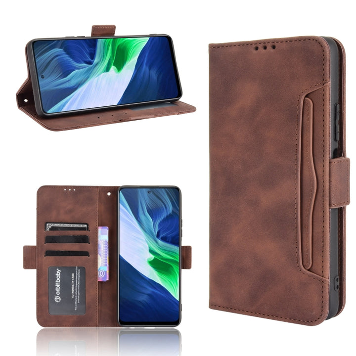 Skin Feel Calf Pattern Horizontal Flip Leather Case with Holder & Card Slots & Photo Frame, For Infinix Hot 10s/10s NFC/10T, For Infinix Note 10 Pro/Note 10 Pro NFC, For Infinix Note 10, For Xiaomi Redmi Note 10 5G, For Xiaomi Redmi Note 10 JP Version