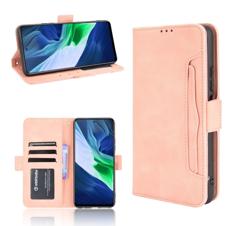 Skin Feel Calf Pattern Horizontal Flip Leather Case with Holder & Card Slots & Photo Frame, For Infinix Hot 10s/10s NFC/10T, For Infinix Note 10 Pro/Note 10 Pro NFC, For Infinix Note 10, For Xiaomi Redmi Note 10 5G, For Xiaomi Redmi Note 10 JP Version