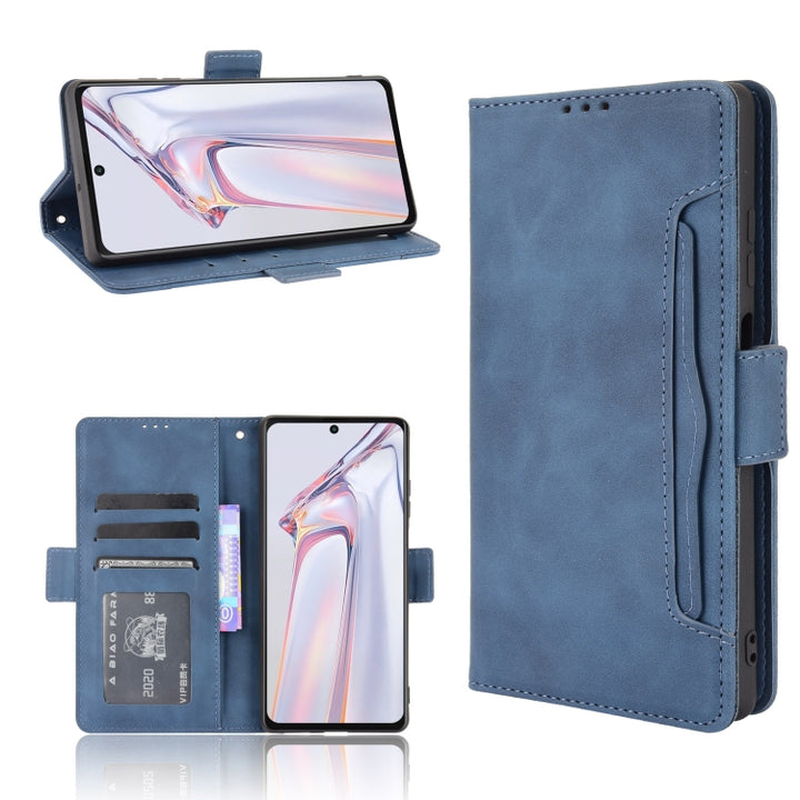 Skin Feel Calf Pattern Horizontal Flip Leather Case with Holder & Card Slots & Photo Frame, For Infinix Hot 10s/10s NFC/10T, For Infinix Note 10 Pro/Note 10 Pro NFC, For Infinix Note 10, For Xiaomi Redmi Note 10 5G, For Xiaomi Redmi Note 10 JP Version