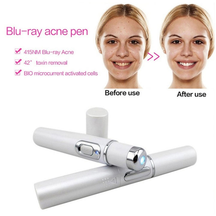 K-SKIN KD-7910 Acne Laser Pen Portable Wrinkle Removal Machine Durable Soft Scar Remover Device Blue Light Therapy Pen