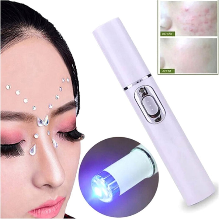 K-SKIN KD-7910 Acne Laser Pen Portable Wrinkle Removal Machine Durable Soft Scar Remover Device Blue Light Therapy Pen