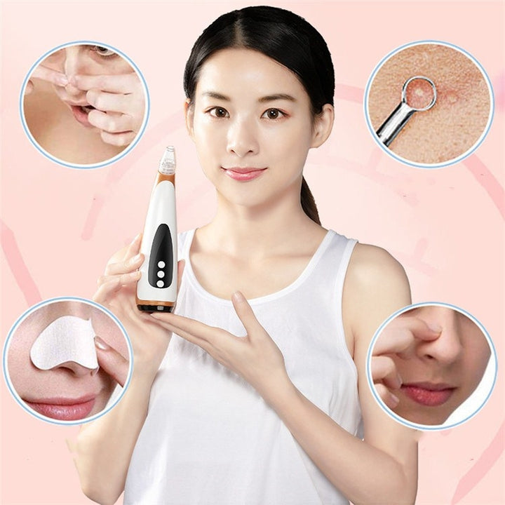 Electric Pore Cleaning Instrument Hot Compress To Export Acne Removing Blackhead Beauty Instrument, Pore Cleaning Instrument(Black)