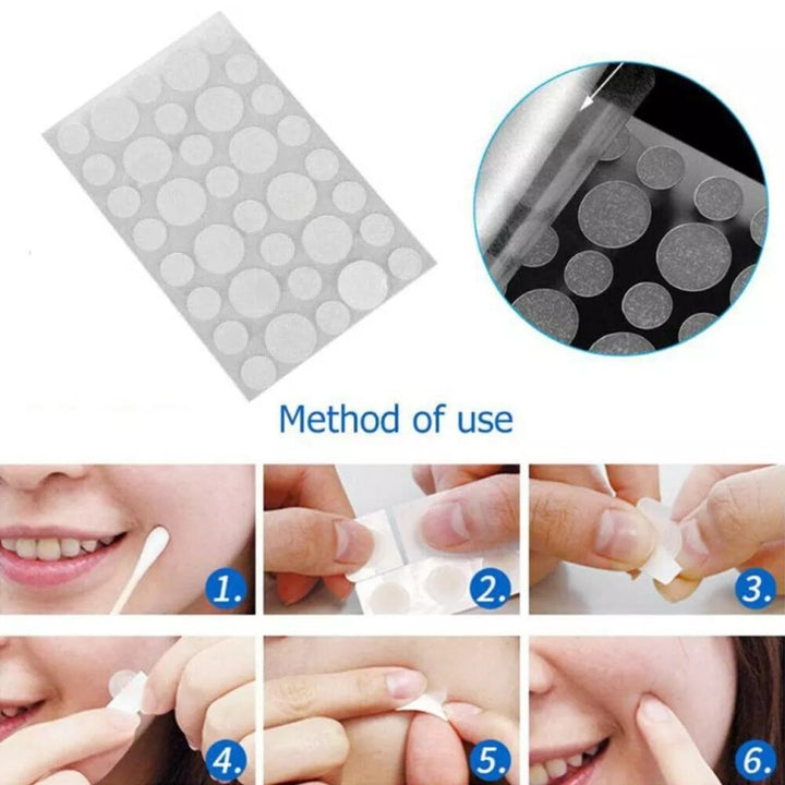 3 PCS Acne Tool Set Treatment Acne Scar  Pimples Sticker