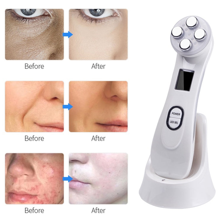 Radio Mesotherapy Electroporation Face Beauty Pen Radio Frequency LED Photon Face Skin Rejuvenation Remover Wrinkle