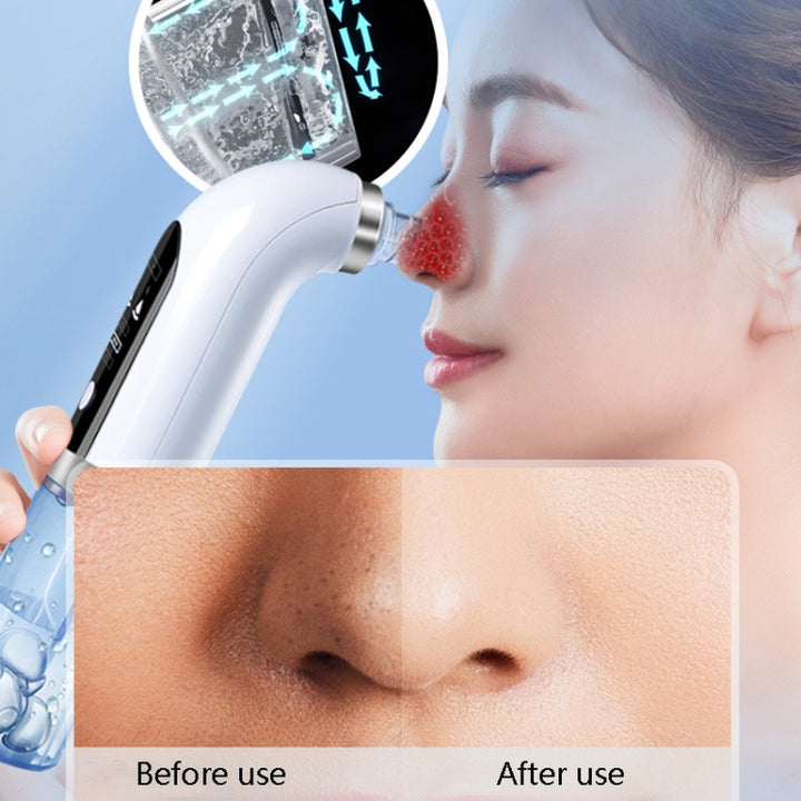 Small Bubble Home Beauty Equipment Multifunctional Electric Blackhead Suction Instrument Facial Pore Cleaner, FY-SX-128A