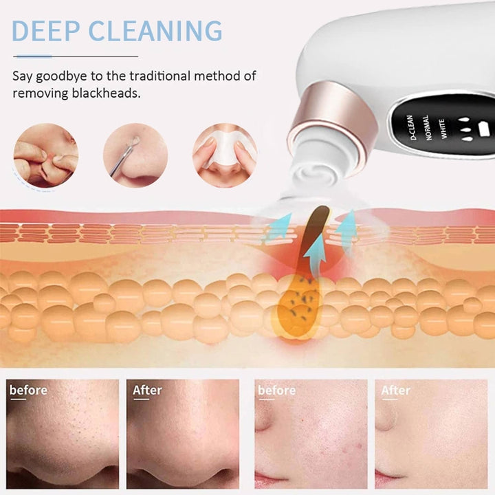 2112-A Water Circulation Pore Vacuum Cleaner Blackhead Remover With 6 Suction Heads, 2112-A