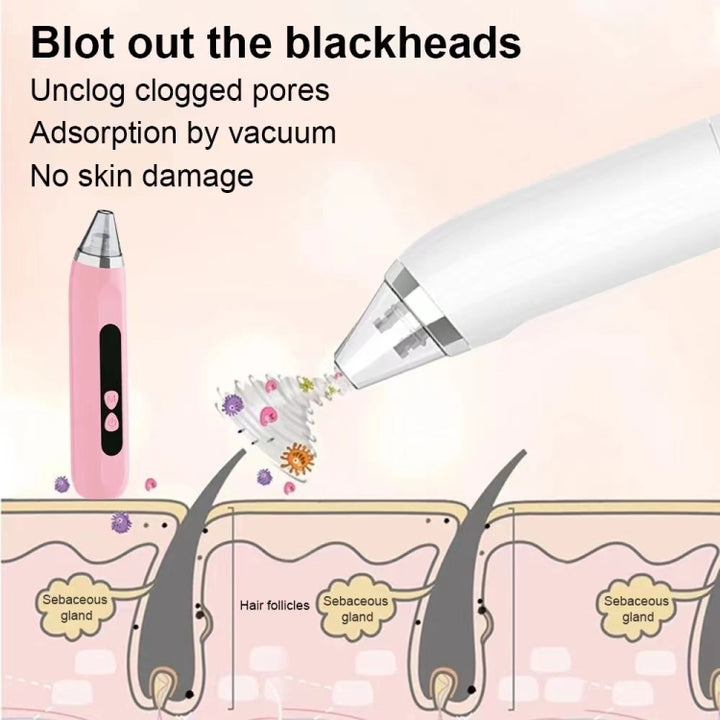 Blackhead Remover Vacuum Pore Cleaner Facial Deep Cleaning Beauty Tools, Dry Battery(White), Dry Battery (Pink)